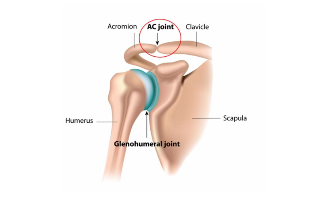 Acromioclavicular Joint Pain Ultrasound Guided Injections