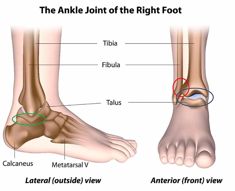 Lateral ankle ligament injury